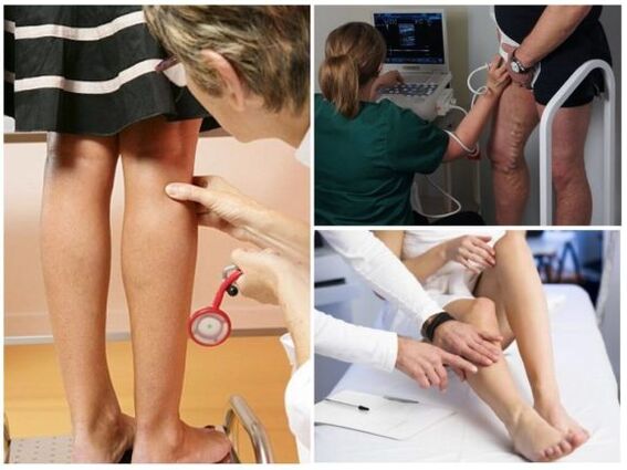 Diagnosis of Chinese veins