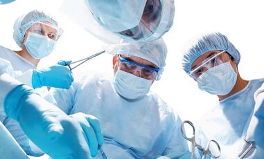 Functional methods to treat veins of vein varicose veins